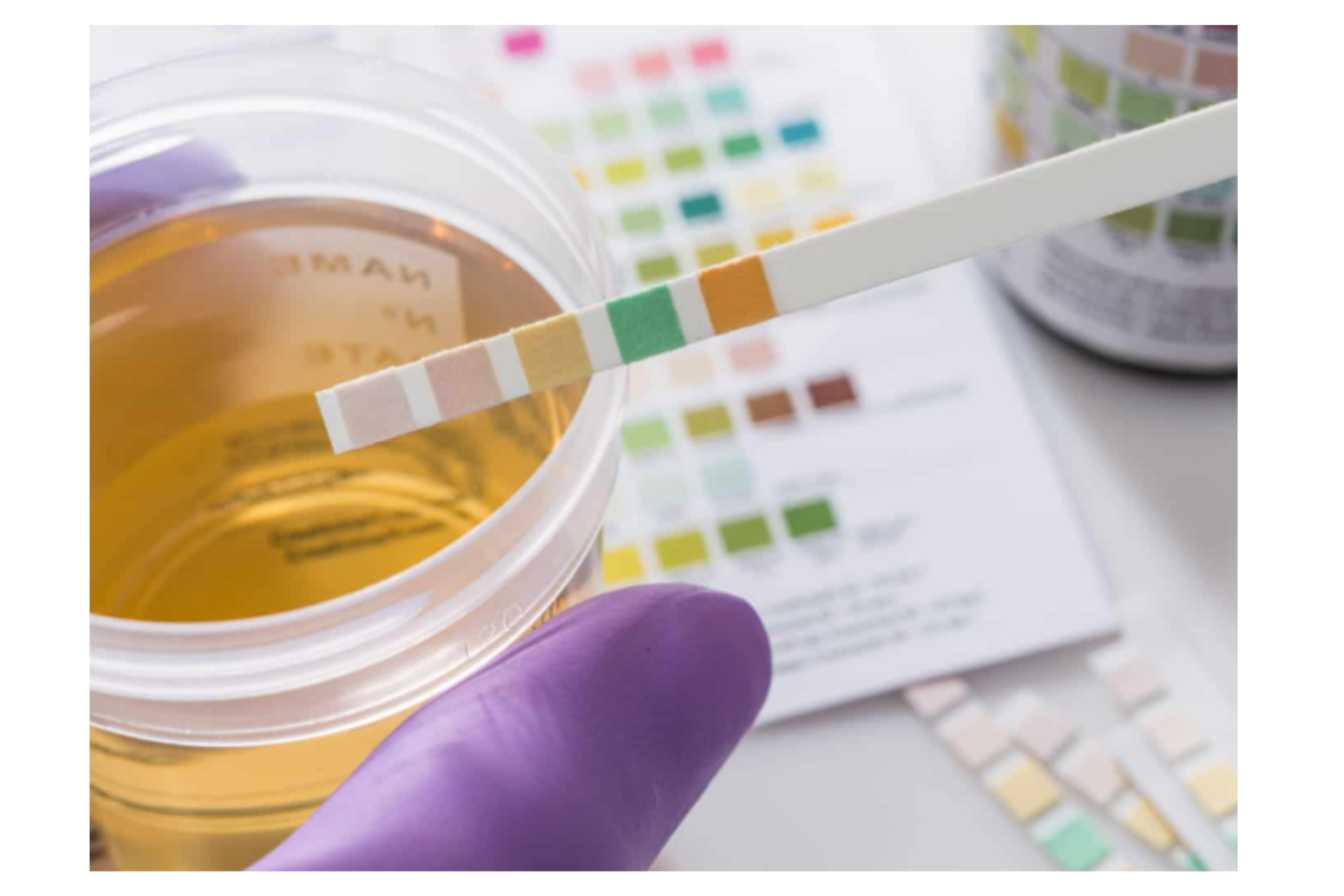 what is a non dot drug test